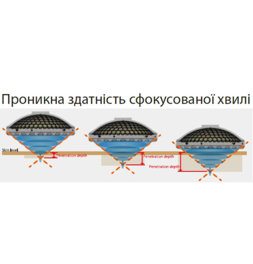 Ударно-хвильовий апарат Young-In Biotech IN-5200